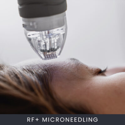Online RF+ Microneedling Course