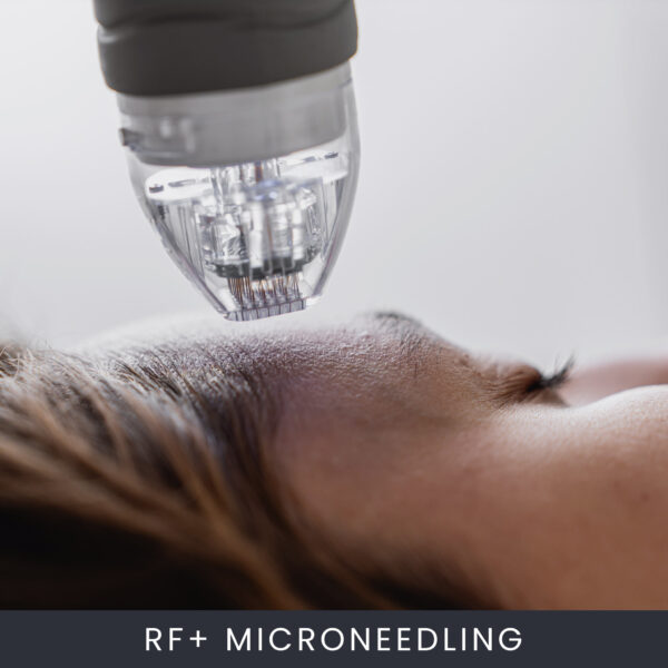 Online RF+ Microneedling Course