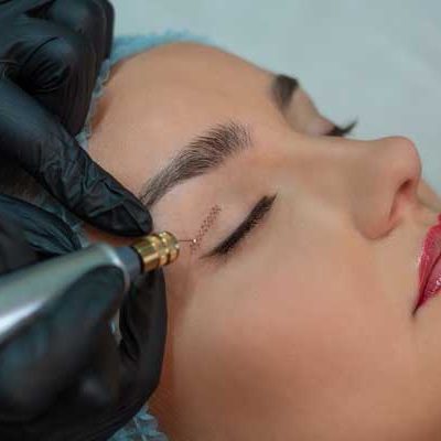 Plasma Fibroblast Skin Tightening Course