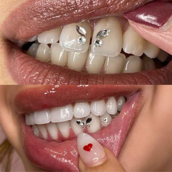 Online Tooth Gem Course